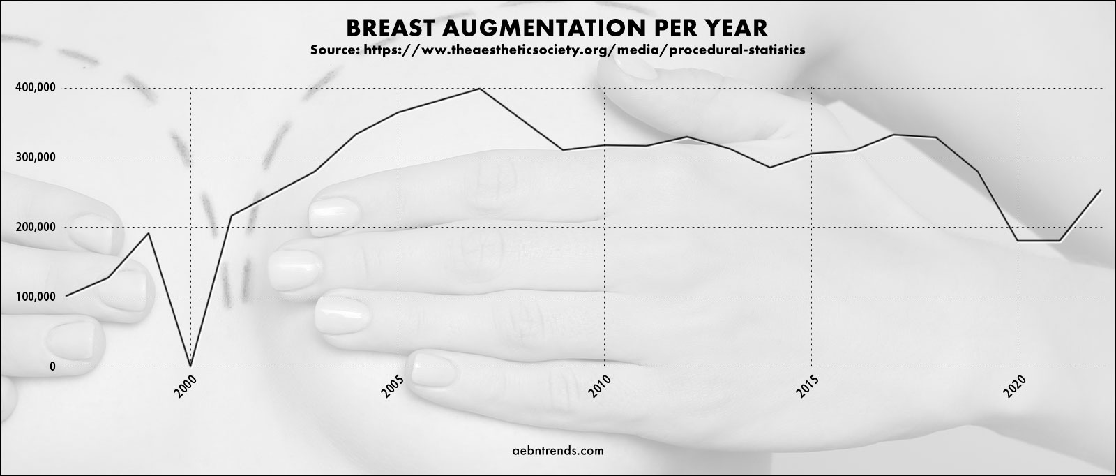 the popularity of breast augmentation was on the rise till 2007 at which point it has been on a marked decline. 